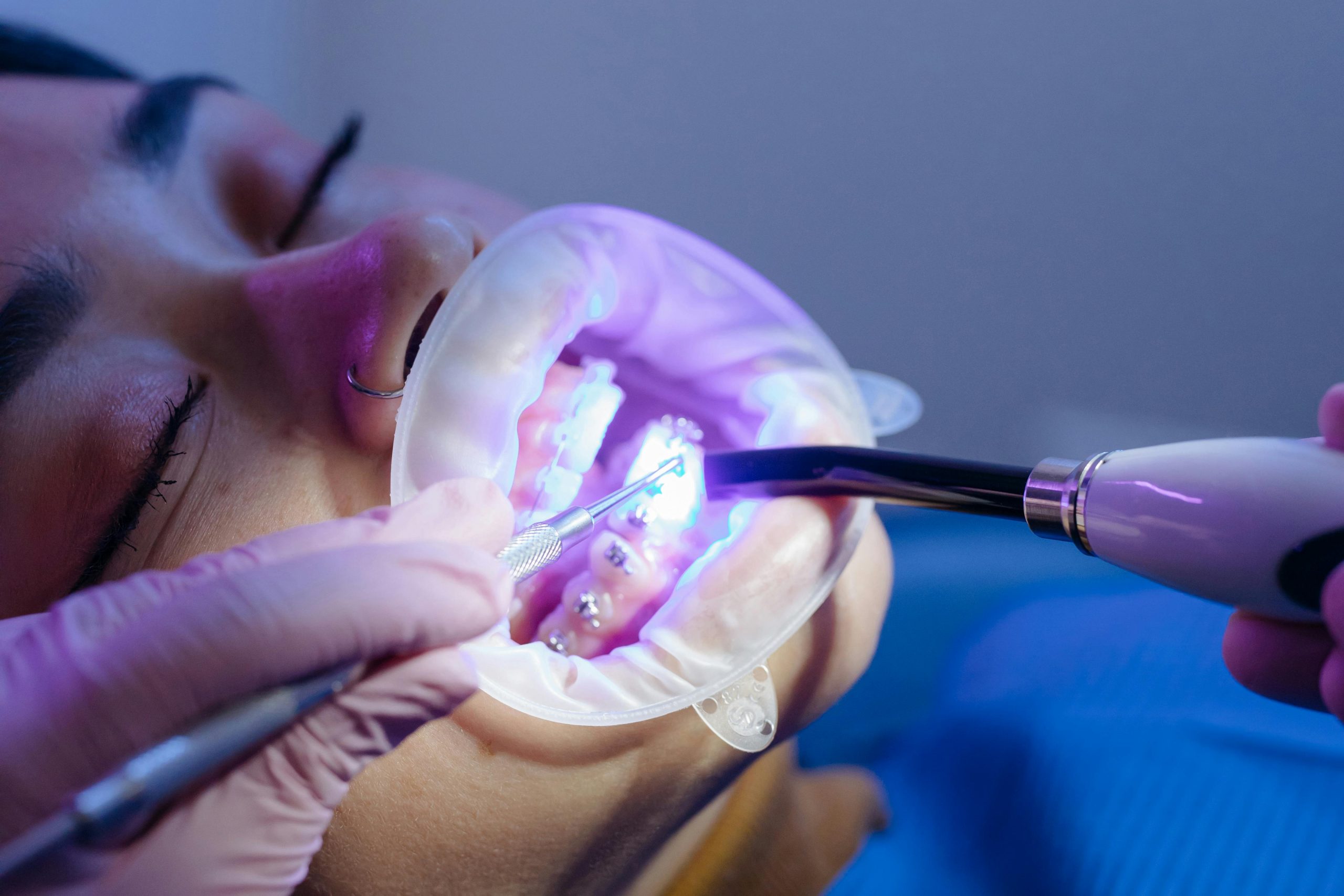 Modern Dentistry Trends in St. Louis for 2025